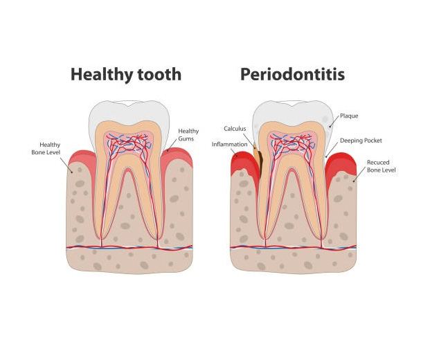 Hygiene/Periodontal Health